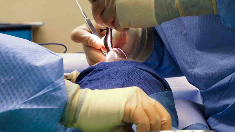 Өзбекстанда пластикалық ота жасатқан қазақстандық әйел қайтыс болды
Қазақстандық әйел мұрнының қисықтығын түзеткен