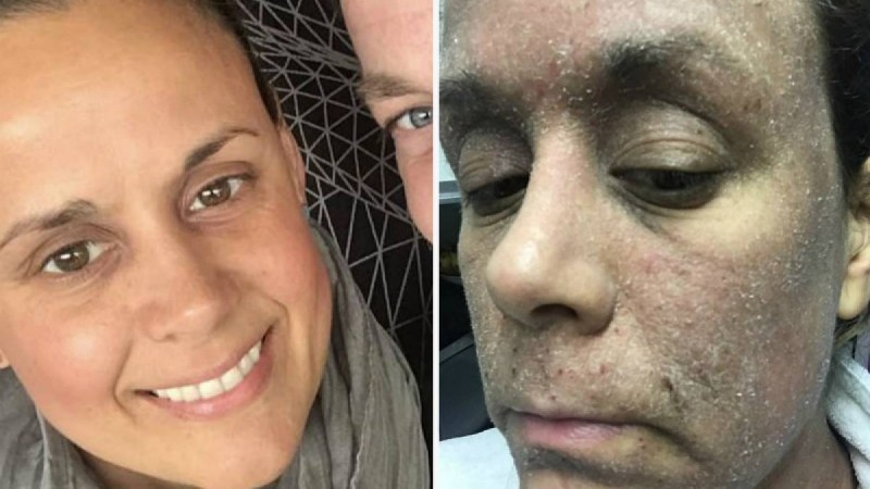 Әйел бетке арналған иісмайдың кесірінен «зомбиге» айналды - Қазақстан жаңалықтары