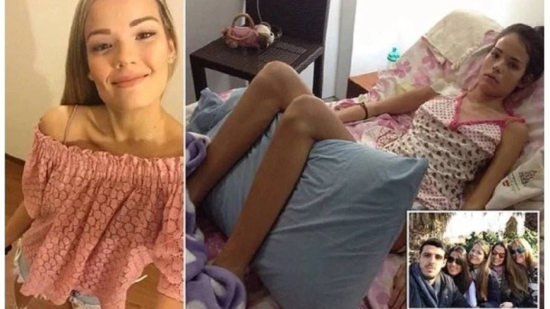 Жүктілікке қарсы дәрі ішкен ару адам сенгісіз жағдайға ұшырады (ФОТО)