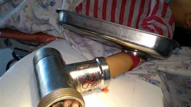 Ет турағыш машина сәбидің саусақтарын жұлып кетті