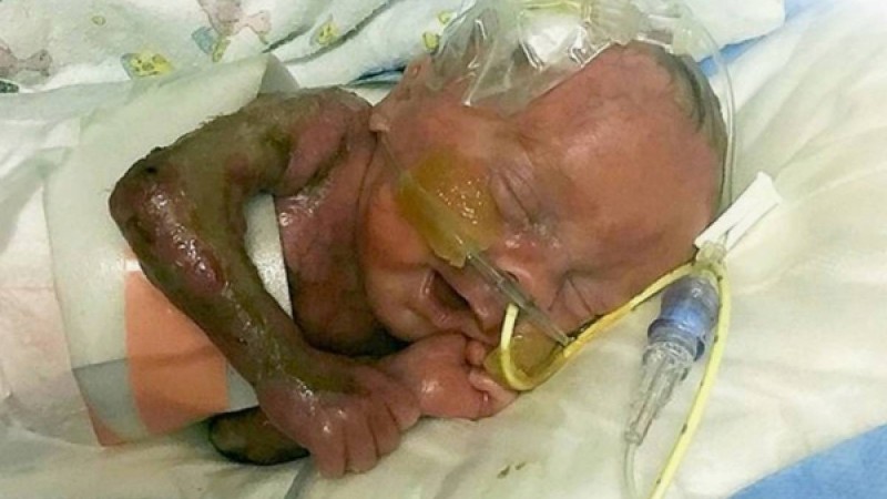 Терісі жоқ бала дүниеге келді