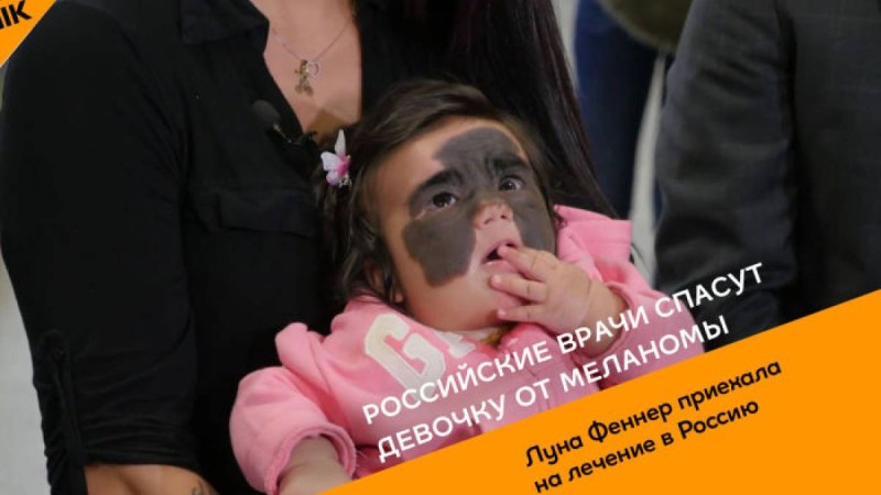 Дәрігерлер қызды меланома дертінен құтқарады – видео