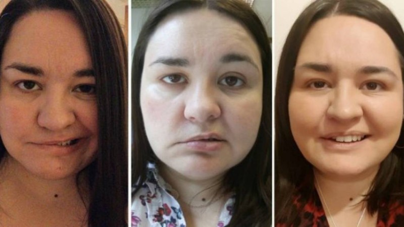 Көп жұмыс істеген әйелдің беті қисайып қалды - Қазақстан жаңалықтары