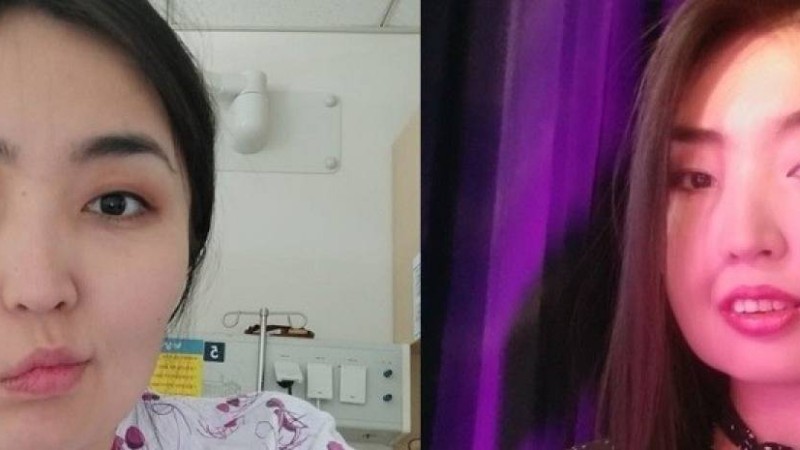 Қазақстандықтар емі үшін 32 мың доллар жинаған алматылық бойжеткен отадан соңғы бет-жүзін көрсетті
                                Мадина: Менін денсаулығым үшін алаңдаған, ота жасауға ақша жинаған әрбір жанға алғысым шексіз