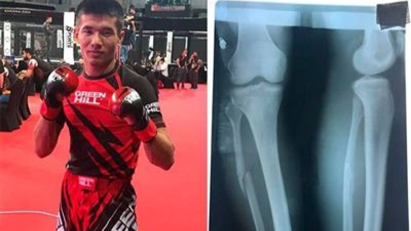 Қазақстандық спортшы сынған аяғымен жеңіске жетті