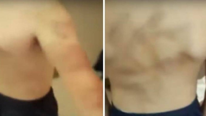 Алматы облысында 8 жасар бала ауруханаға түсті