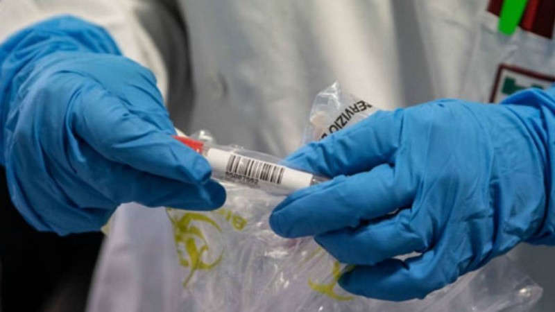 Қазақстанда коронавирус жұқтырғандар саны 900-ден асты