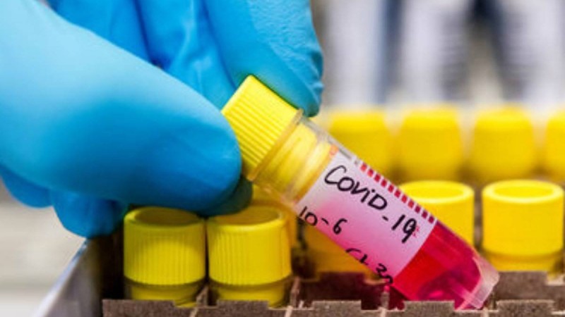 Қытайлық дәрігер COVID-19 эпидемиясының әлемдік шарықтау шегін атады - Қазақстан жаңалықтары