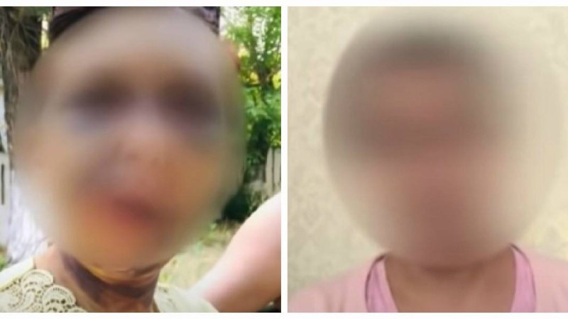 "Ауызында бір тісі жоқ": Шымкентте белгісіз біреулер аяусыз соққыға жыққан әйелдің әпкесі оқиға туралы айтып берді - Қазақстан жаңалықтары