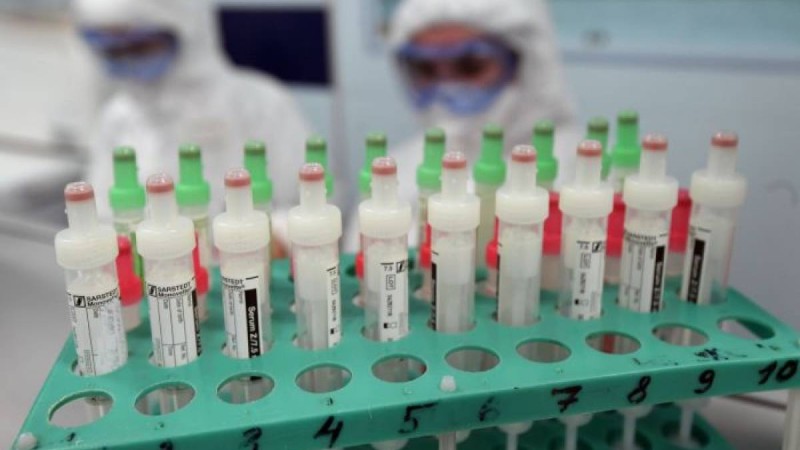 коронавирус індетіне шалдыққандар саны 859 адамға жетті