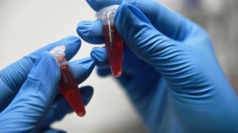 Ресей коронавирус диагностикасына арналған тест-жүйелер әзірледі