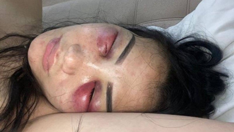 "Жігітім ұрып-соғып, ақшамды алып қояды": Алматы тұрғыны жантүршігерлік суретін жариялады - Қазақстан жаңалықтары