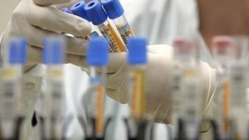 Қытайда тағы бір аса қауіпті вирус тарады - Қазақстан жаңалықтары