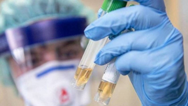 Бірінші тест теріс нәтиже көрсеткен: Павлодарда вирустан көз жұмғандардың саны неге көп - Қазақстан жаңалықтары