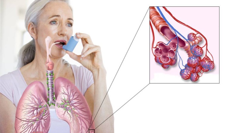 Дүниежүзілік демікпеге қарсы күрес күні