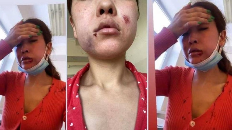 "Көлікке қамап қойып ұрып-соқты": Түркістандық бұрынғы әйелін аяусыз ұрған