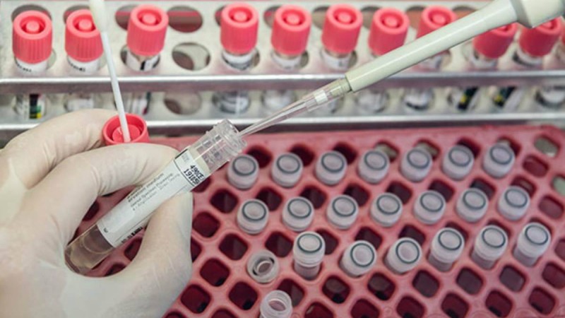 Қандай қалаларда коронавирусты талдау нүктелері пайда болады - Қазақстан жаңалықтары