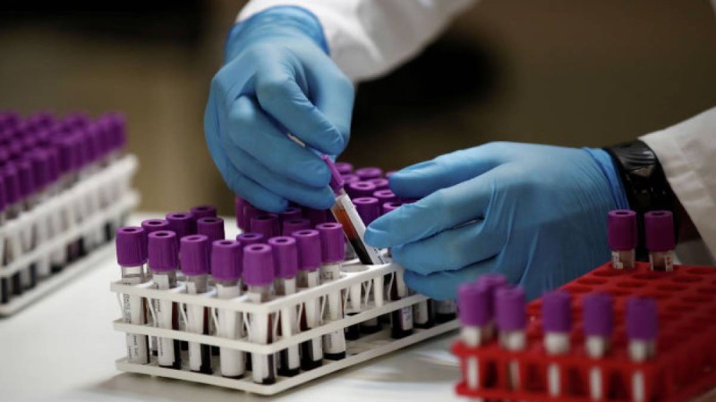 Елімізде індетке шалдыққандар саны 13 мыңнан асты