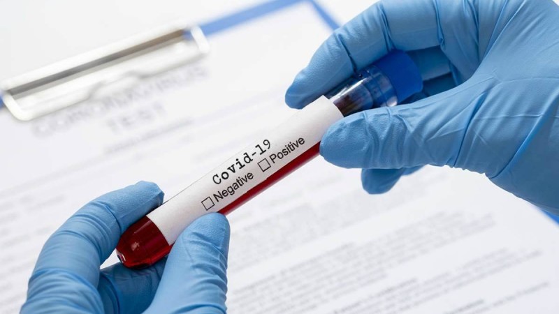 Қазақстанда бір тәулікте 339 асимптоматикалық коронавирус тасымалдаушысы анықталды - Қазақстан жаңалықтары