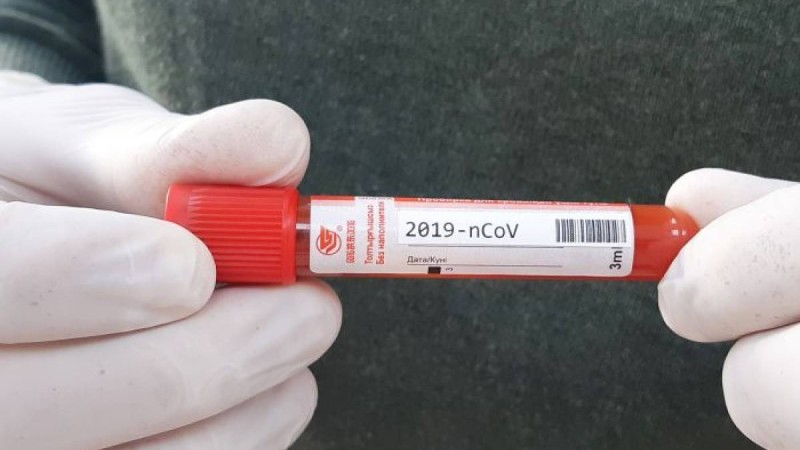 Теңіз мұнай кен орнында жұмыс істейтін әйелден коронавирус табылды