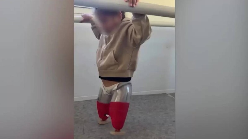 Астанада қос бірдей аяғынан айырылған Алуа протезбен алғашқы қадамын жасады (ВИДЕО)