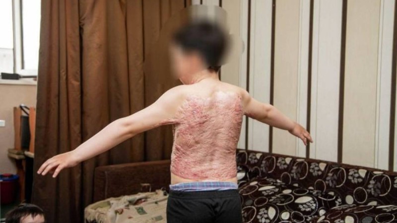 Үйде ешкім болмаған: елордалық баланың ауыр тағдыры елдің назарын аударды