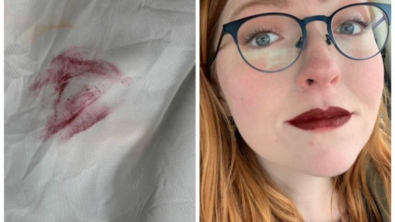 Бірден селфи жасап, желіде жариялаған: Жол апатына ұшыраған қыз ерніндегі далап үшін уайымдаған