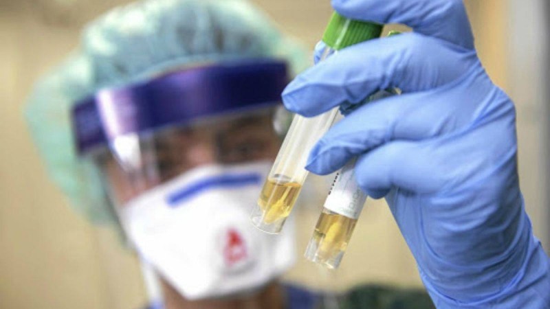 Елде коронавирус жұқтырғандар саны 700-ден асты - Қазақстан жаңалықтары