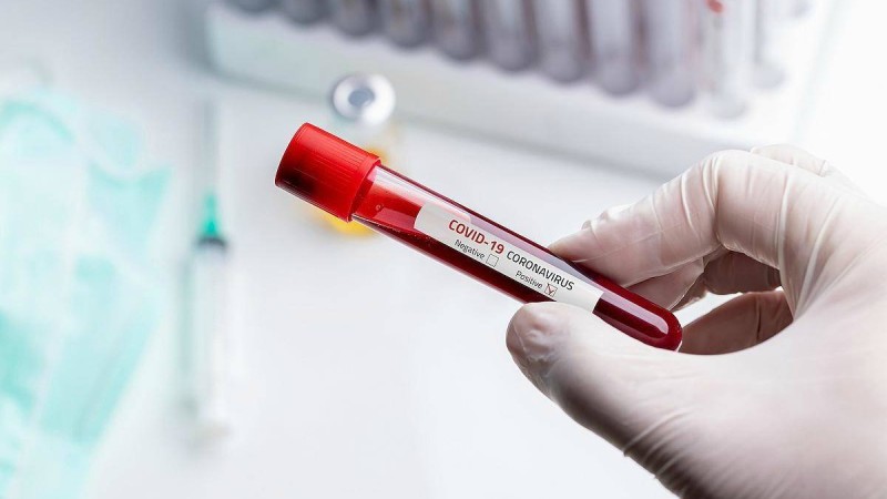 Қазақстанда коронавирус жұқтырғандар саны 700-ге жуықтады - Қазақстан жаңалықтары