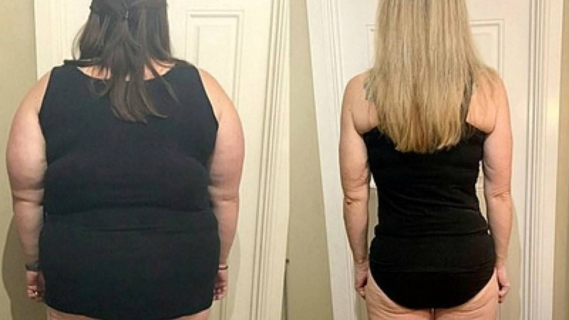 Әйел 76 келіден арылып, артық салмақ жоғалтудың тиімді әдісін ашты - Қазақстан жаңалықтары