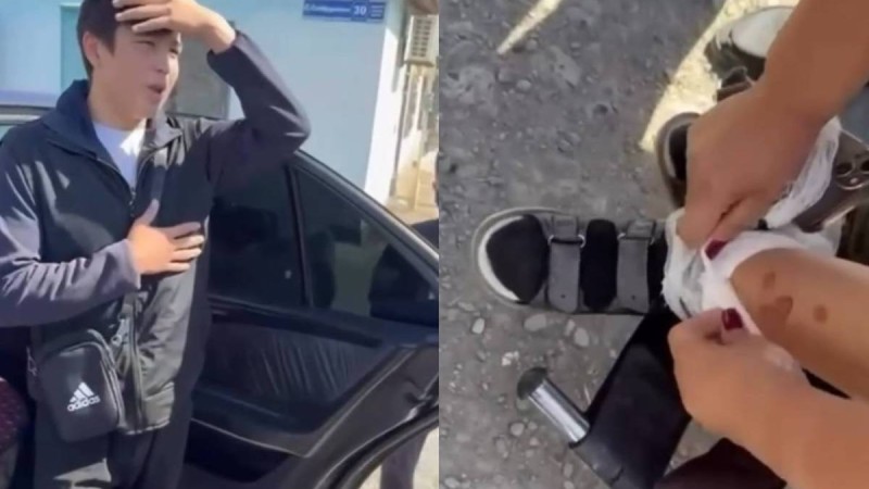 Мүгедек баланың аяғын әдейі күйдіріп қорлаған жасөспірімдер жұрт ашуын туғызды