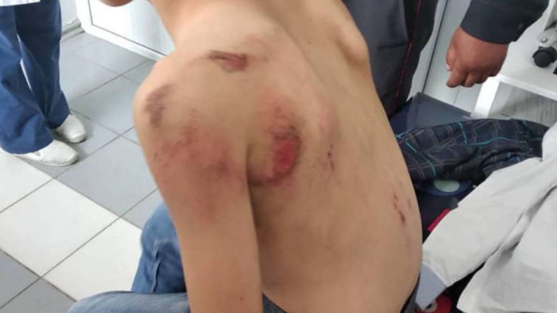 Бішкек тұрғыны 9 жасар жиенін көлікке байлап сүйреген