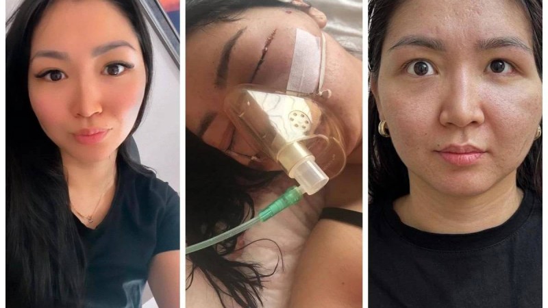 Балаларының көзінше 25 рет ұрған: Сот әйелінің бас сүйегін сындырған астаналықтың жазасын жеңілдетіп, бостандыққа шығармақ