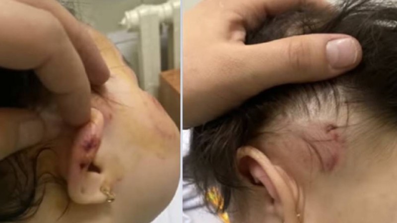 Балабақшада бір жарым жасар қызды ұрып-соқты: Оқиғаға қатысты мәліметтер шықты