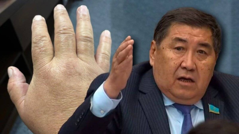 Улады ма?: Ермұрат Бапи бес айдан бері белгісіз дертке шалдыққан
