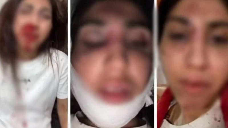 Балаларының көзінше жағы мен мұрнын сындырған: Бұрынғы күйеуінен таяқ жеген әйел Президенттен көмек сұрады