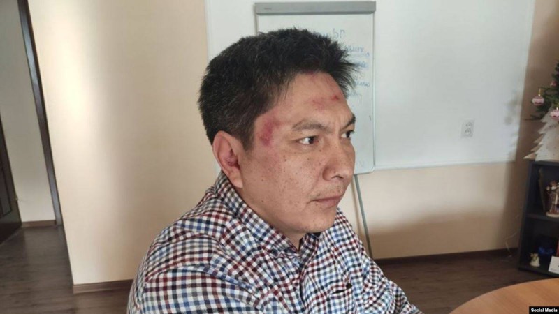 Тергеу органдарына сенбейтінін айтқан қырғыз журналисі өзіне жасалған шабуылды зерттейтінін айтты