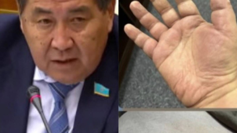 "Улаған деген күдік бар". Депутат Ермұрат Бәпи денсаулығы туралы айтты