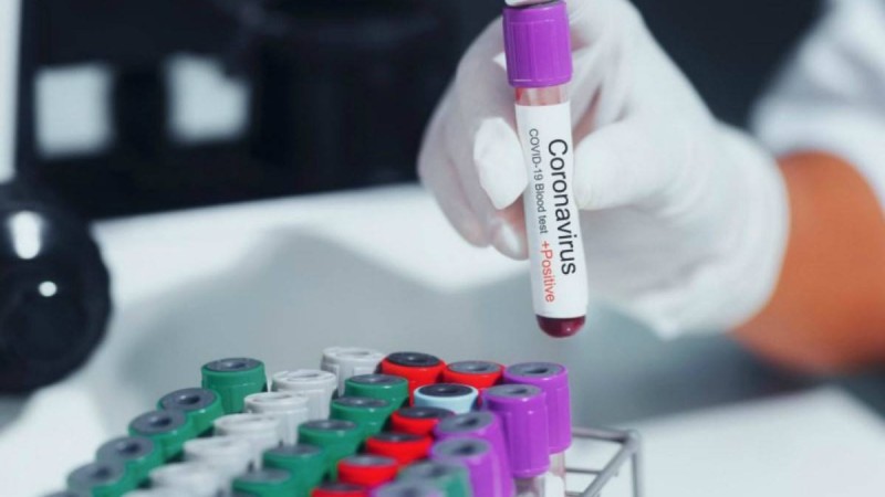 Қазақстанда коронавирус жұқтырғандардың саны 372-ге жетті - Қазақстан жаңалықтары