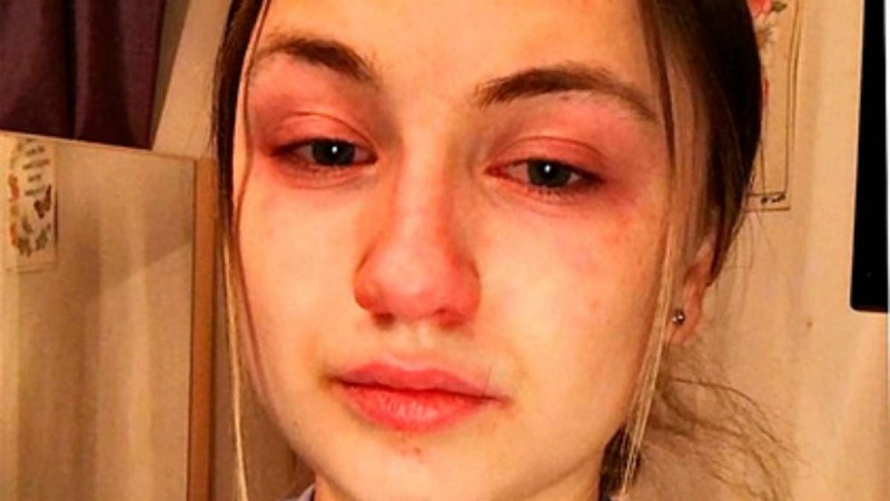 Күніне 13 сағат жұмыс істейтін медбике коронавирус жұқтырғандардың азабы туралы айтты - Қазақстан жаңалықтары