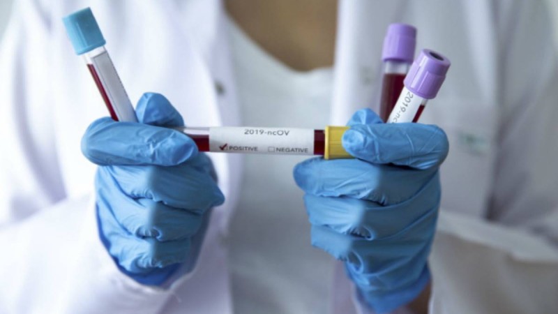 Қызылорда облысында коронавирус жұқтырудың жаңа 6 жағдайы тіркелді - Қазақстан жаңалықтары