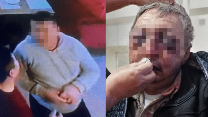 Шымкентте ер адам күзетшіні "қарға отырма" дегені үшін аяусыз ұрып-соққан