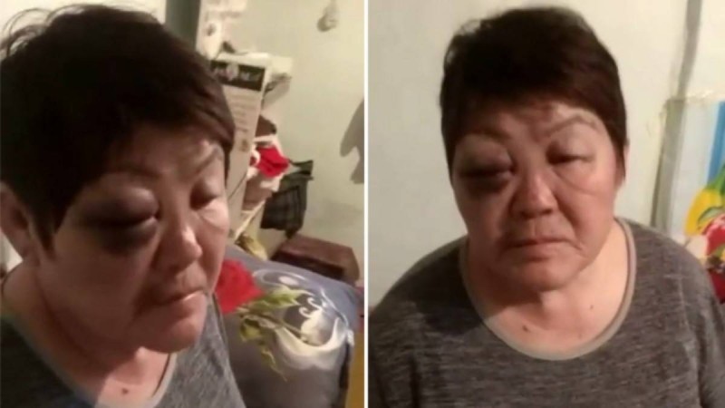 "Балаларыңмен бірге өртеп жіберемін деп қорқытты": Алматы облысының тұрғыны бұрынғы күйеуінің аяусыз ұрғанын айтты