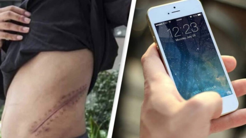 Енді төсек тартып жатыр: Жасөспірім iPhone үшін бүйрегін сатты