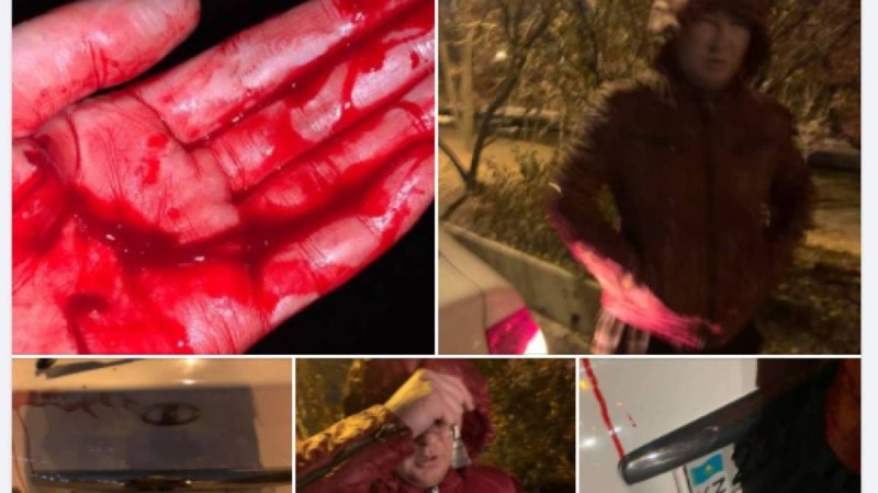 Қолын көтеріп, кесіп тастады: алматылық әйел өзіне шабуыл жасаған такси жүргізушісі туралы айтты