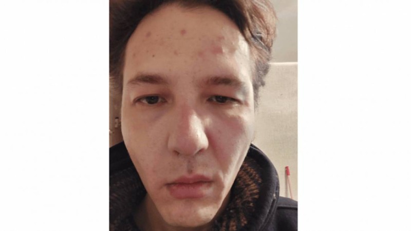 “Тыныш жүр” деп ұрып кетті”: Тәуелсіз журналист Данияр Молдабековке шабуыл жасалды