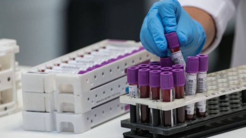 Қазақстанда бір тәулікте 450 адамнан коронавирус табылды