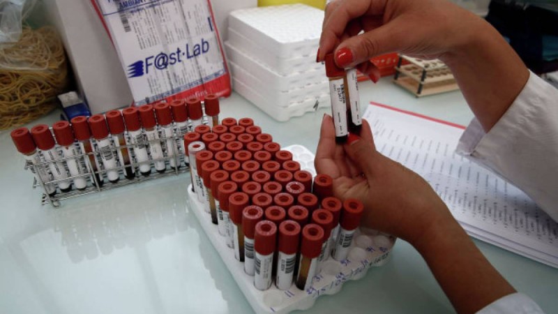 Вирус жұқтырған кейбір адамдар неге ауруханаға жатқызылмайды - министр жауабы