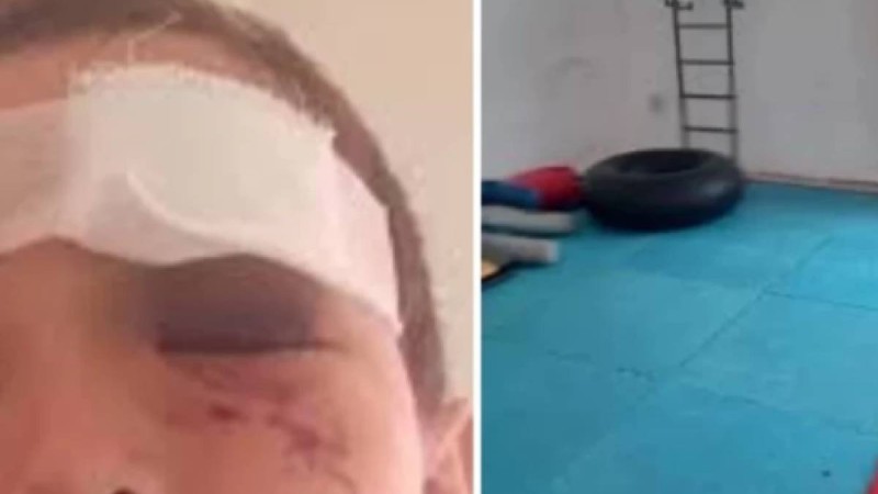 Оралда бес жасар бала MMA үйірмесіндегі қайғылы жағдайдан кейін бір көзінен айырылды