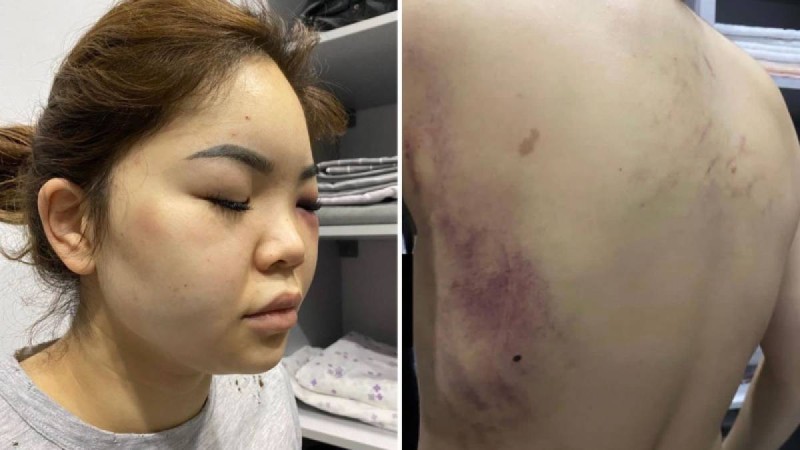 Астаналық әйелді бұрынғы күйеуі оңдырмай сабап тастады